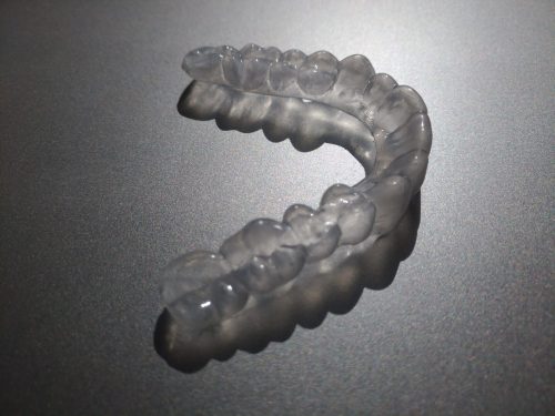 aligner photo 2